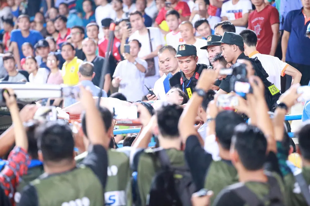 CĐV nhập viện vì dính pháo sáng: Sân Hàng Đẫy đứng trước án phạt nặng ảnh 3