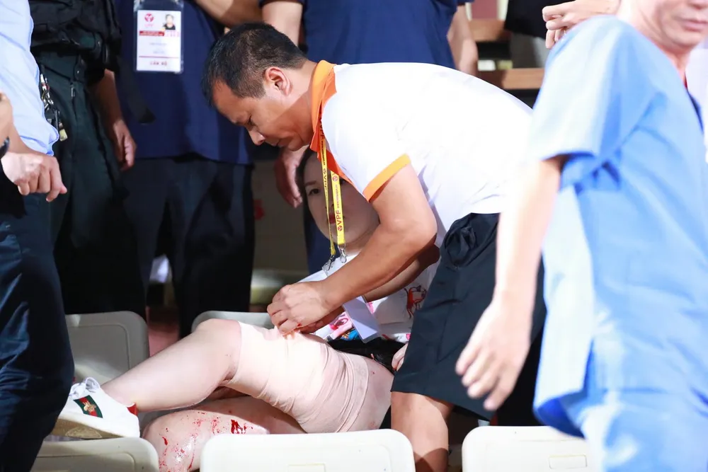 CĐV nhập viện vì dính pháo sáng: Sân Hàng Đẫy đứng trước án phạt nặng ảnh 2