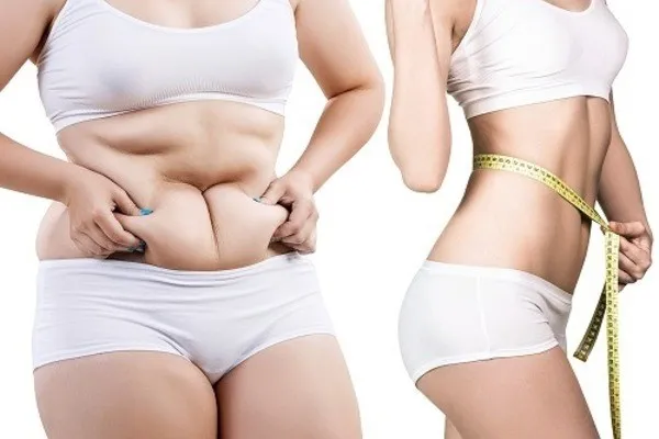 Giải pháp mới hiệu quả cho người thừa cân, béo phì ảnh 1 Giải pháp mới hiệu quả cho người thừa cân, béo phì ảnh 1