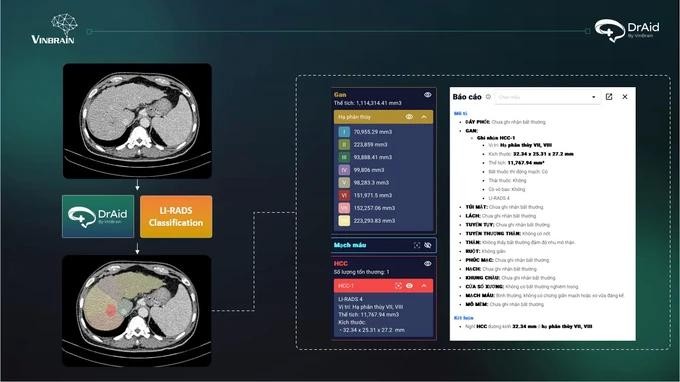 The DrAid Enterprise Data platform, developed by VinBrain, is an AI application specifically designed for the healthcare sector AI.webp