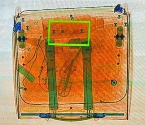 The image was captured from the screening process. The image was captured from the screening process.