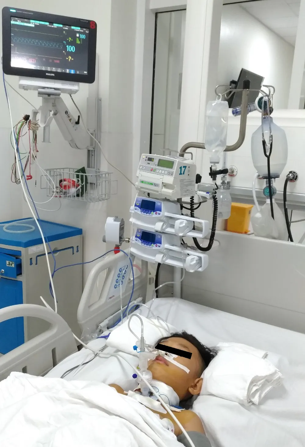 Bất cẩn khi chơi xe trượt điện, bé trai bị vỡ thanh quản ảnh 1 Bất cẩn khi chơi xe trượt điện, bé trai bị vỡ thanh quản ảnh 1