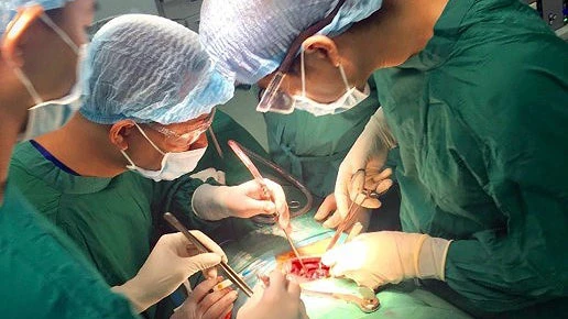 Các bác sĩ đang tiến hành ghép tạng