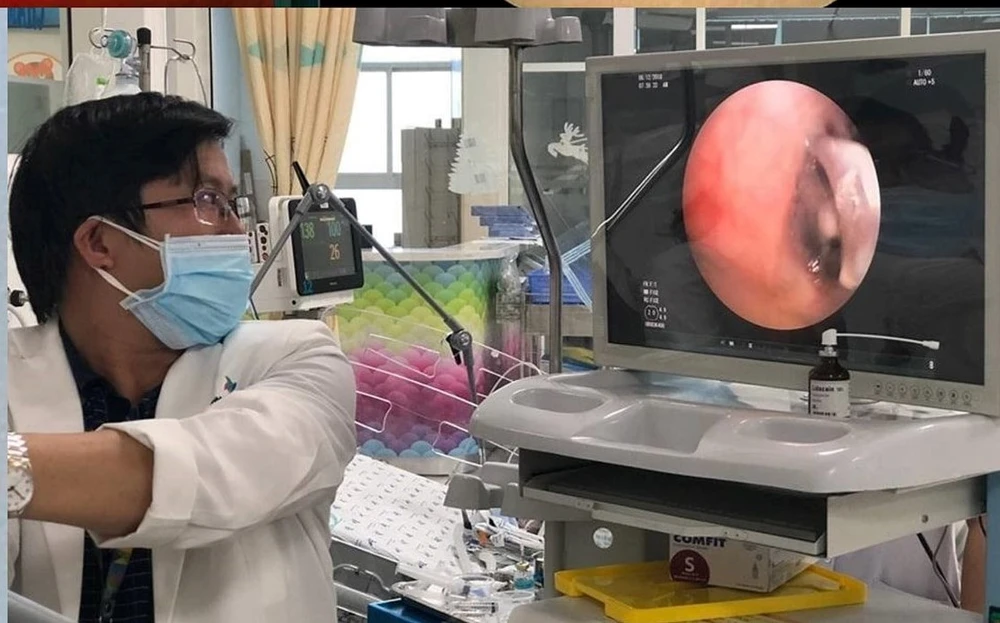 Bác sĩ đang nội soi gắp dị vật