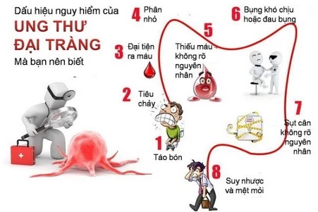 Dấu hiệu ung thư đại trực tràng