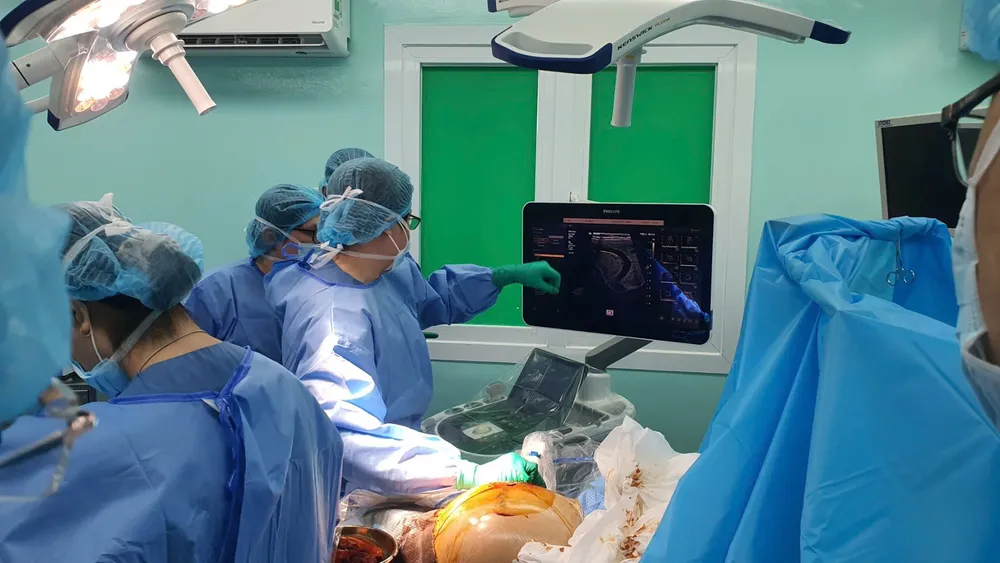 Các bác sĩ Bệnh viện Đại học Y Dược TPHCM đang can thiệp bào thai thai phụ