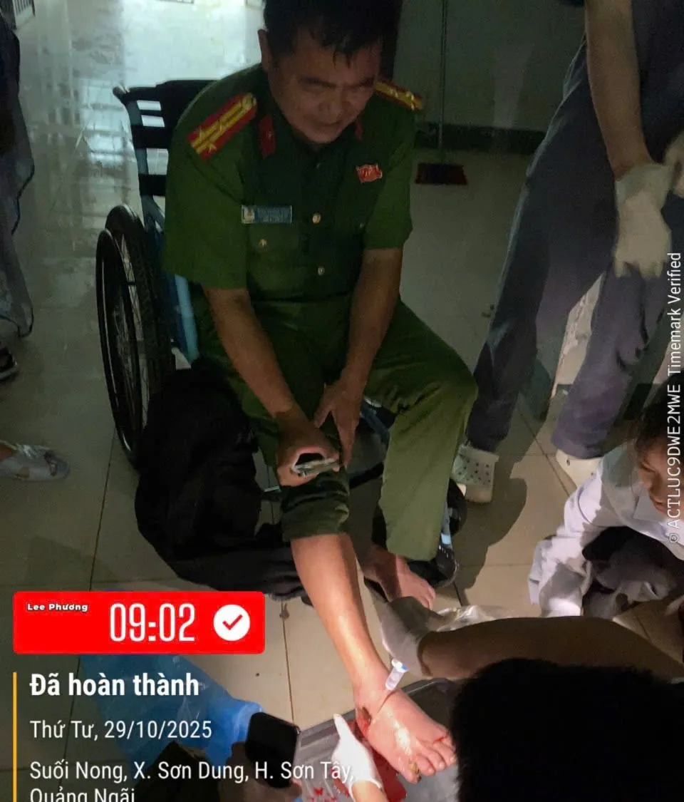 Thượng tá Đinh Quang Tiến bị cây gỗ đâm xuyên bàn chân phải trưởng công an