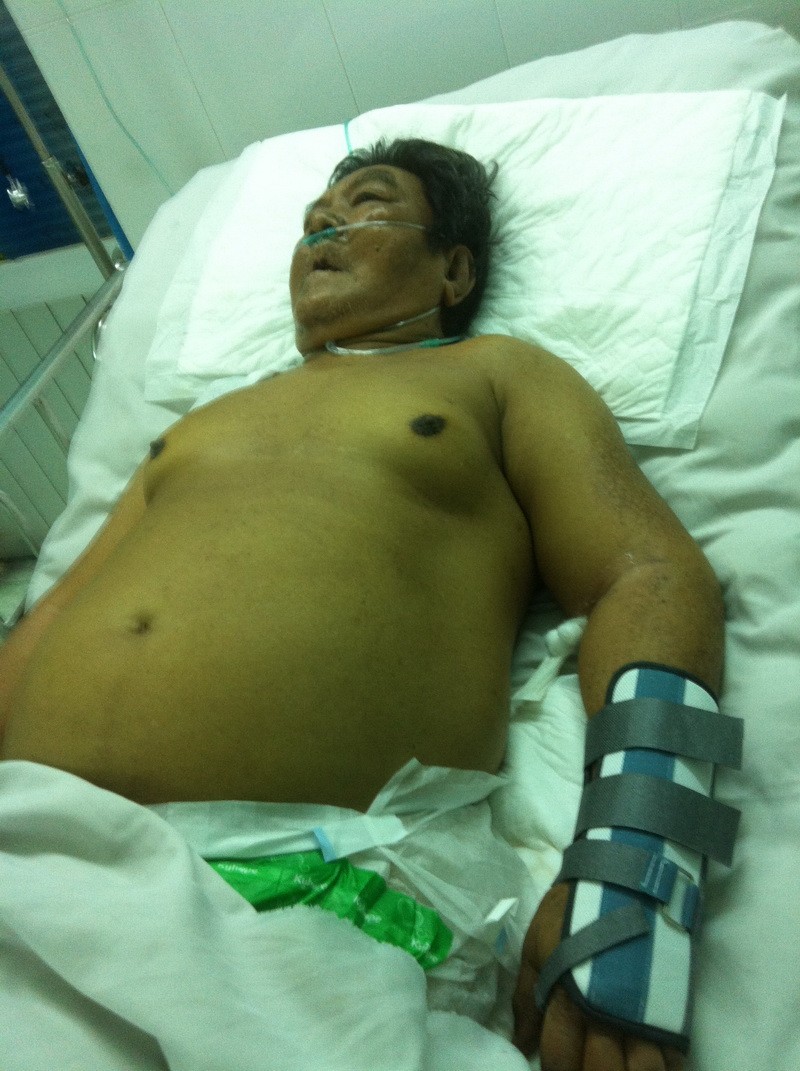 由於病情嚴重，文榮仍留在重症急救室接受治療。