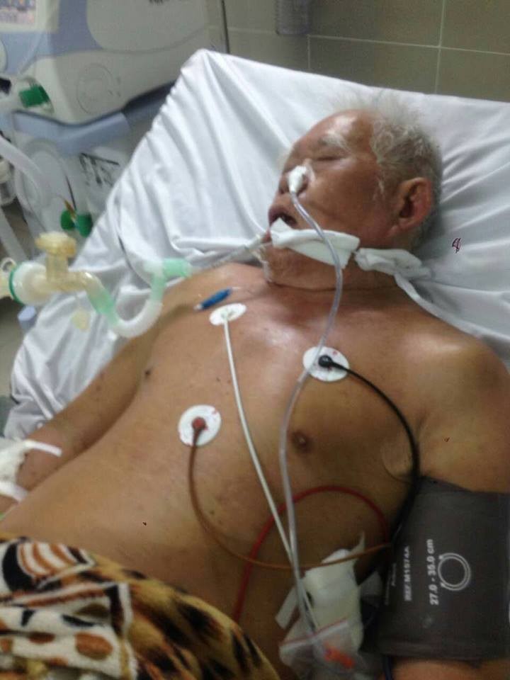 八旬病人仍在昏迷