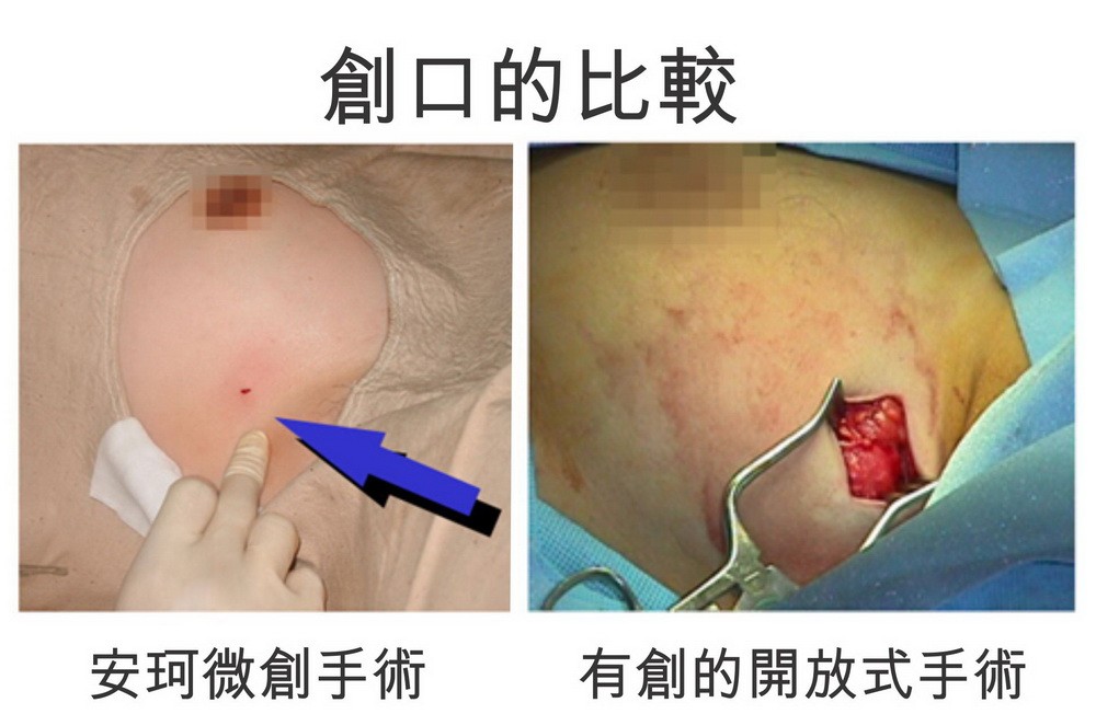 （資料圖源：聖丹福廣州現代腫瘤醫院）