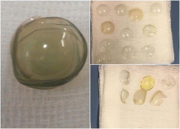 （資料圖源：互聯網）