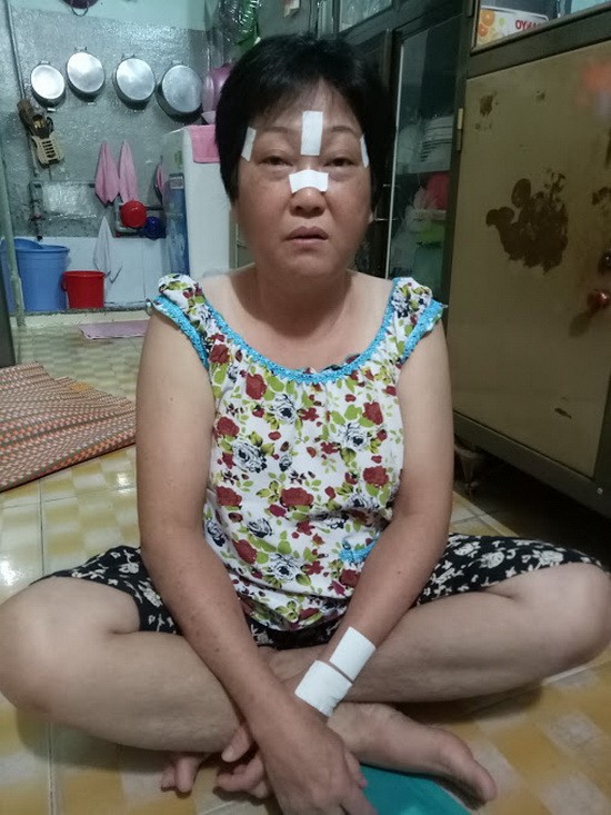 蔡玉蘭病情反覆發作，導致頭劇痛、眼睛紅腫、血壓下降。