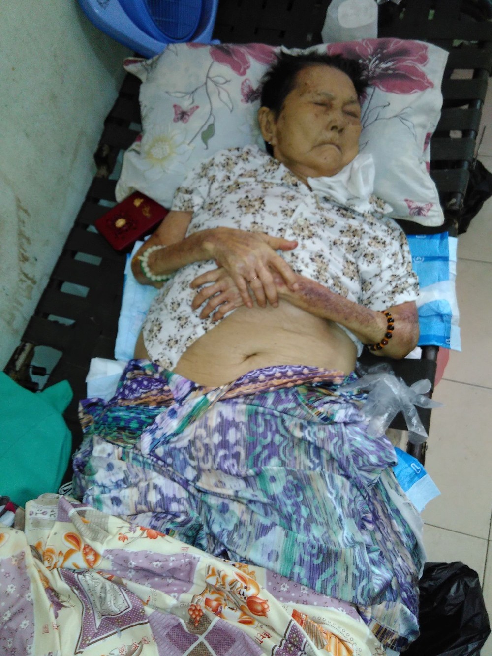 陳鳳大娘自從患病後身體衰弱。
