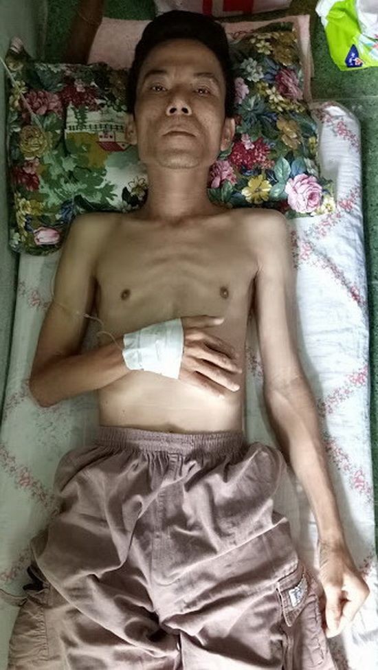鄧偉發病倒身體消瘦無力。