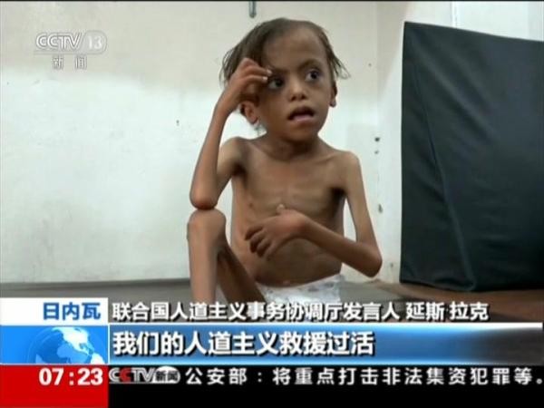 聯合國警告封鎖使也門面臨大饑荒。(圖源:CCTV視頻截圖)