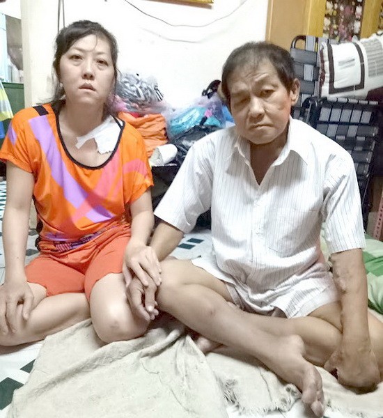 丈夫患末期腎衰竭，艾青又遭車禍，真是禍不單行。