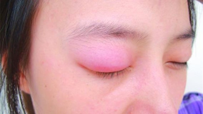 這樣腰痛當心是腫瘤 ảnh 1