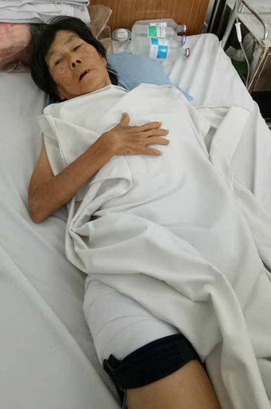 玄官在施手術的第二天獲轉出病房。