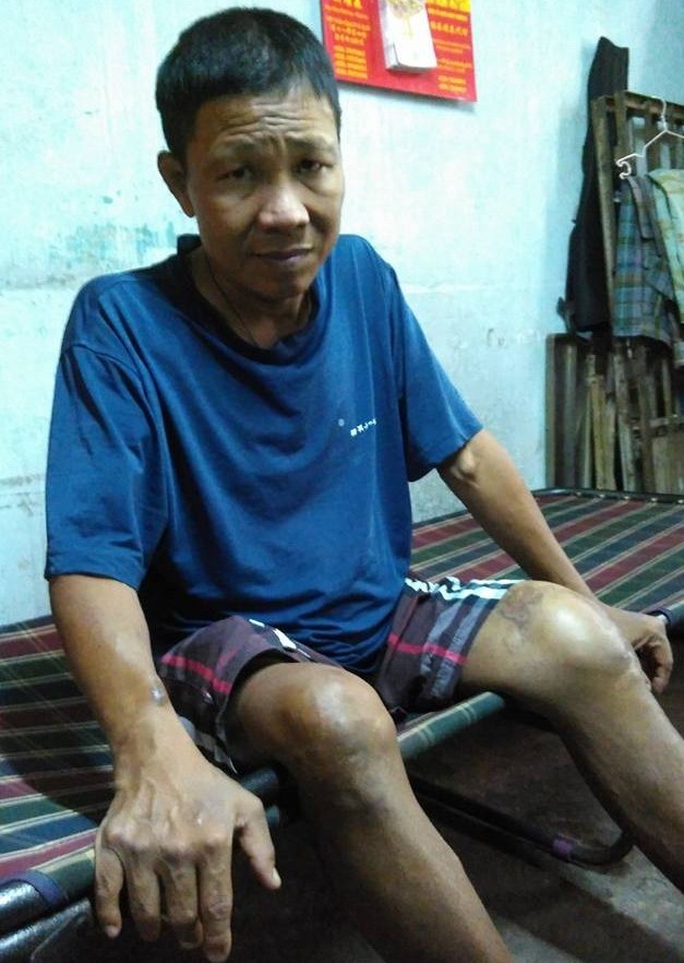 身患多病的張耀華。