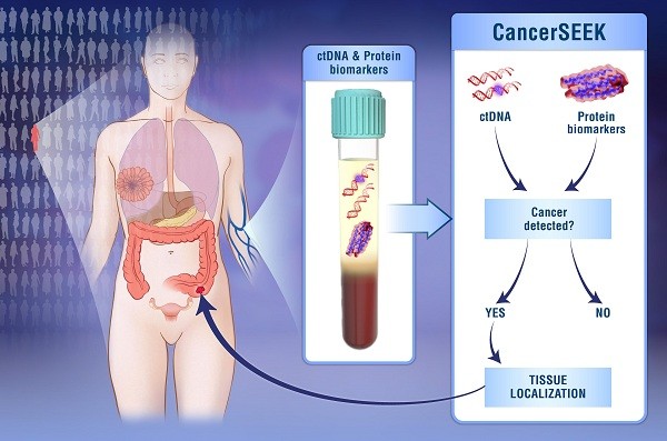 這種名為CancerSEEK的無創檢測方法由美國約翰斯·霍普金斯大學研究人員開發，能通過檢測血樣中16種與癌症相關的基因突變及8種蛋白質，查出卵巢癌、肝癌、胃癌、胰腺癌、食管癌、結直腸癌、肺癌與乳腺癌。（圖源：互聯網）