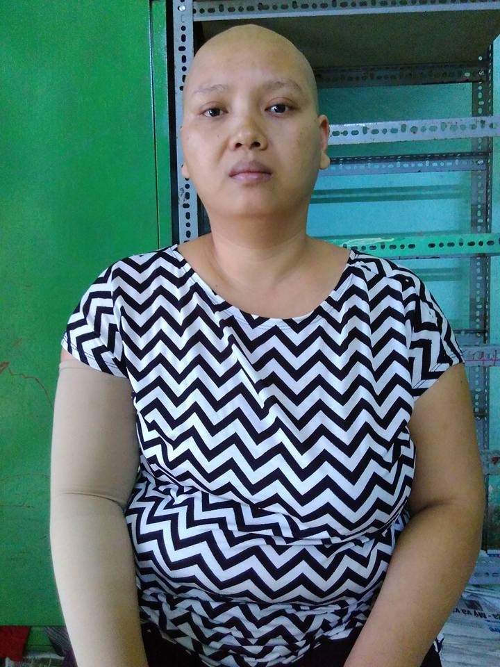 不幸患著乳癌的潘氏雪娥。