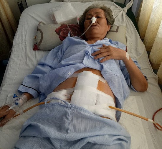 方燕蓮施手術後身體還很虛弱。