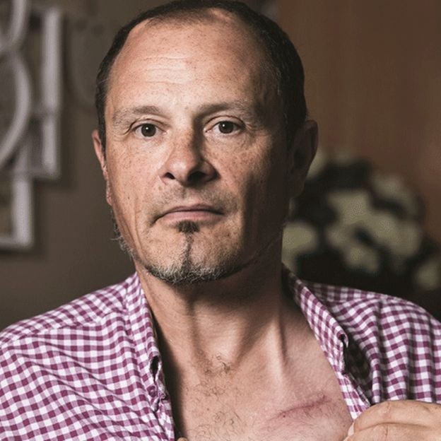 皮下植入晶片其實也痛苦 ảnh 1