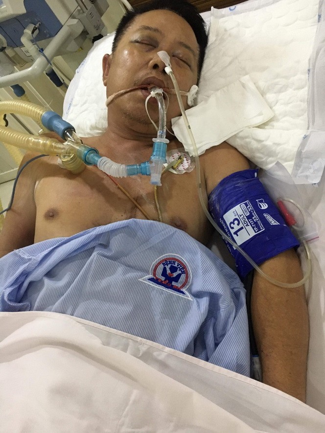 郭光明陷入深昏迷狀態。