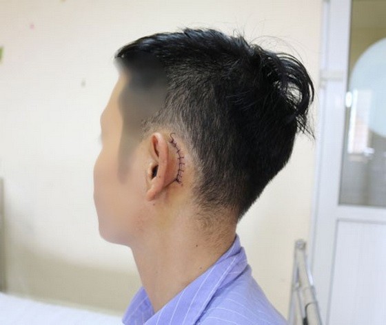 接受手術後的傷者。（圖源：院方提供）