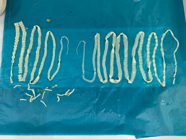 患者服用驅蟲藥後排出體外總長共約4米的兩條條蟲。（圖源：院方提供）