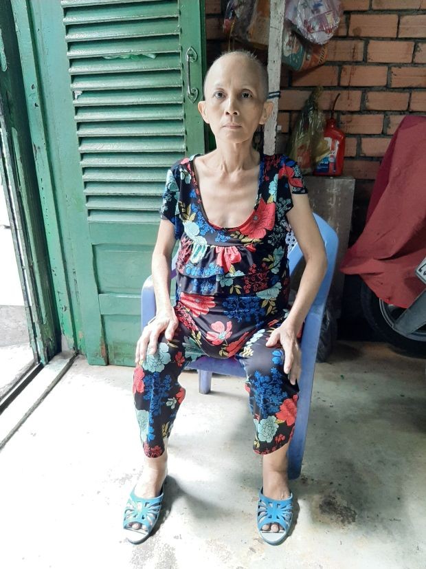 卵巢癌病患者急須幫助 ảnh 1