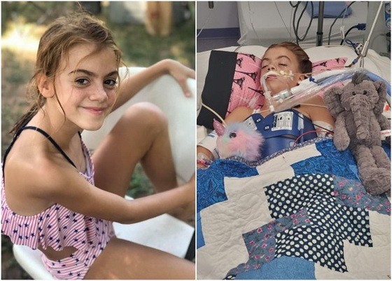 阿文特在河中戲水後感染食腦變形蟲。（圖源：互聯網）