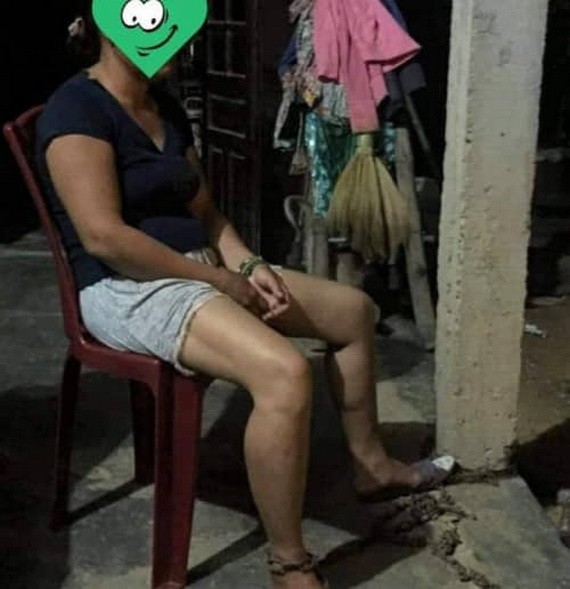 受害者阮氏G遭其丈夫酒後用鐵鍊把腳踝鎖在屋柱毆打。
