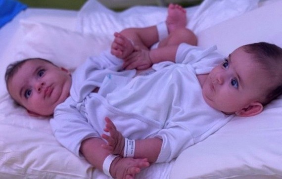 這對雙胞胎分別為艾哈邁德和穆罕默德。（圖源：互聯網）