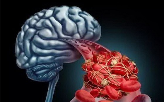 （示意圖源：互聯網）