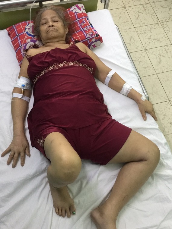 馮穗正在安平醫院接受醫治。