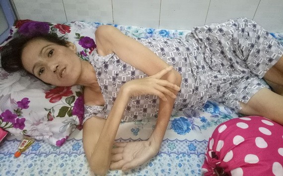 張秀冰病倒後身體消瘦，生活不能自理。