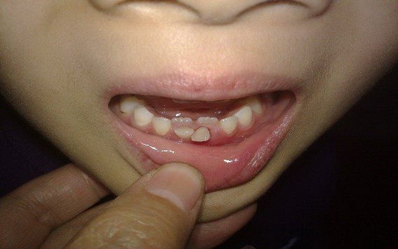 （示意圖源：互聯網） 