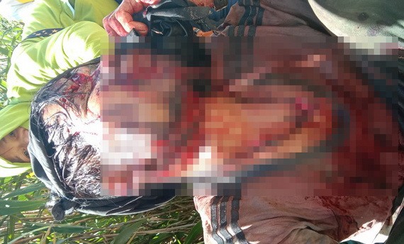 傷者胡文會遭野熊攻擊，傷勢十分嚴重。（圖源：黃君）