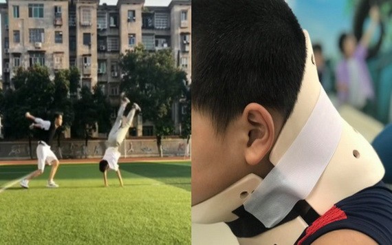 因模仿抖音(TikTok)視頻上的翻跟斗動作而扭傷了頸椎的10歲男童（右圖）。（圖源：田升）