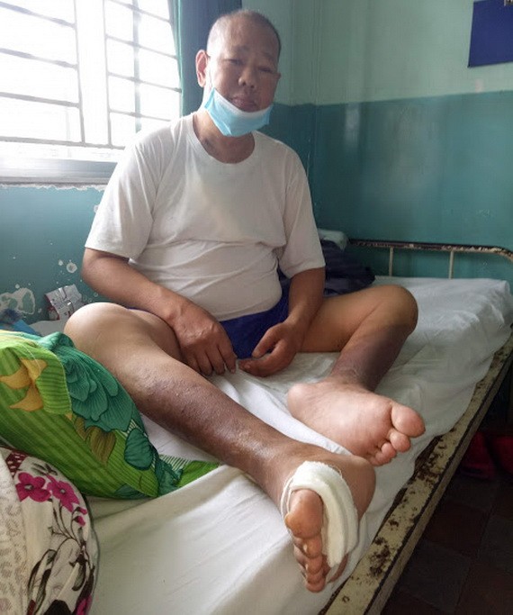 周國勇在安平醫院接受醫治。