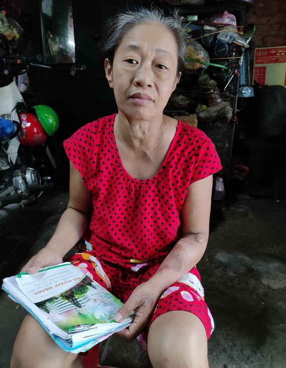 陳枝梅患上腎衰竭,手臂浮腫。