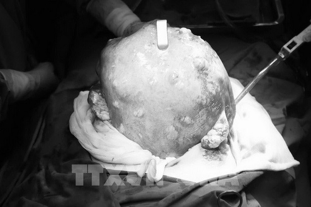 選擇無科學治療　一病人險些喪命 ảnh 1