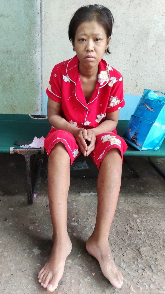 自從患上末期腎衰竭，李金蓉的身體消瘦無力。