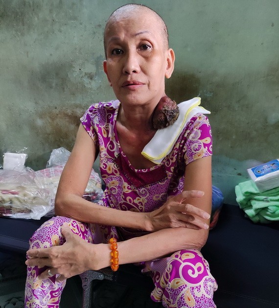 吳玉鳳接受化療後，腫瘤開始變小了。