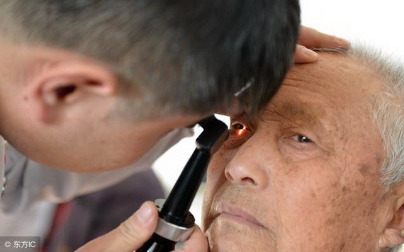 老年人還有哪些常見眼病?