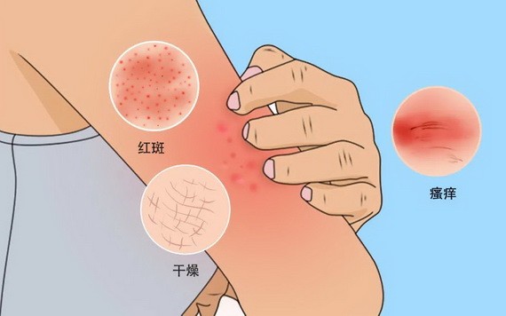 皮膚感染嚴重時或危及生命