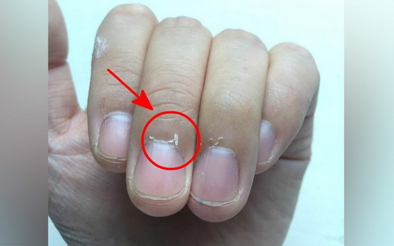 三個正確處理倒刺方法!