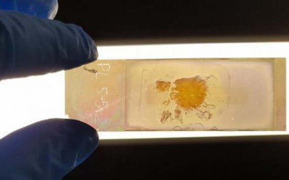 澳洲研發新型顯微鏡載玻片，可快速識別癌細胞。（圖源：互聯網）