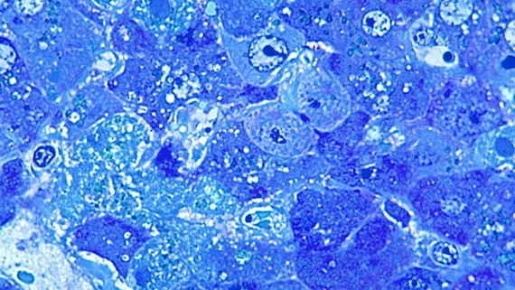 拉沙熱病毒。（圖：互聯網）